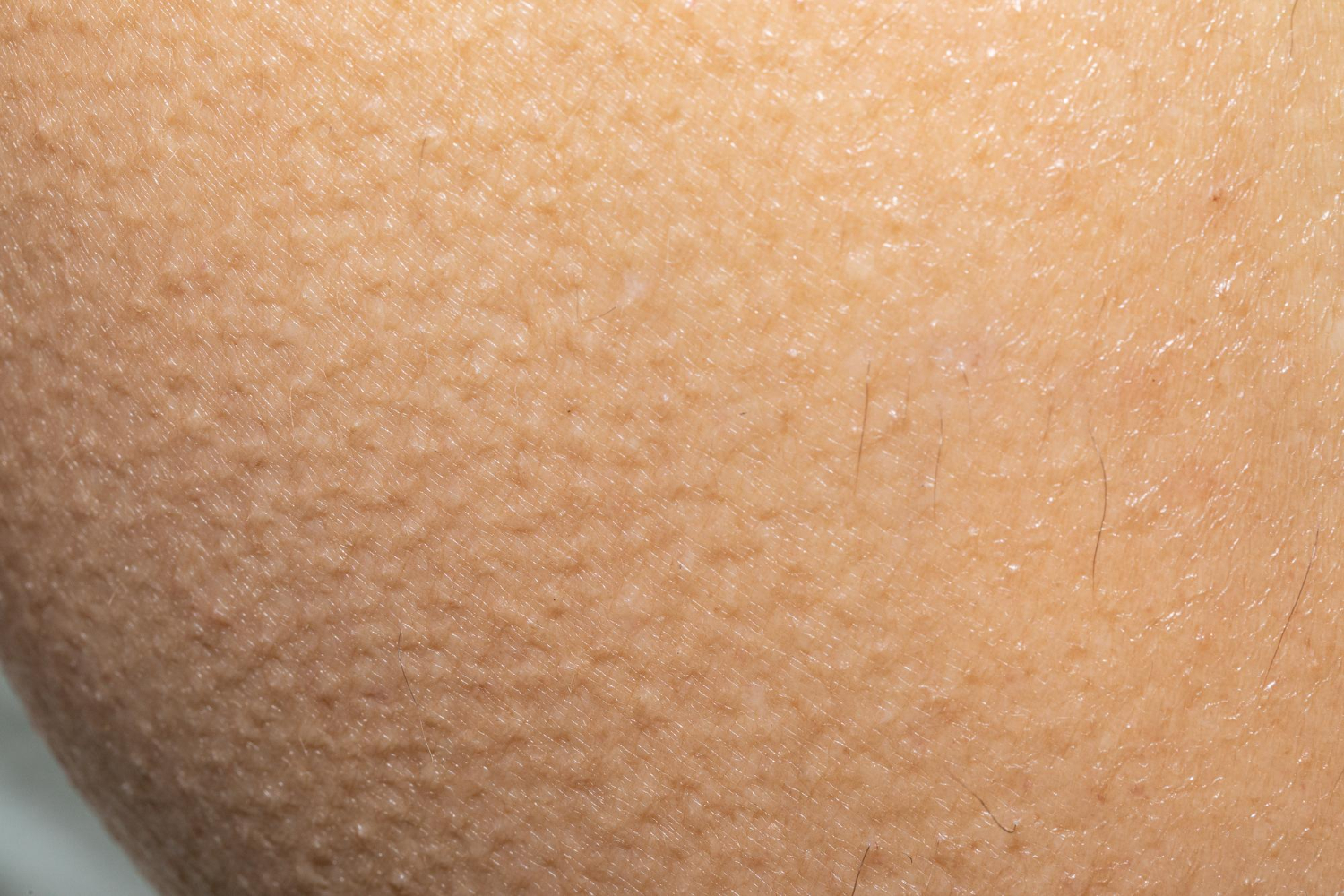 human skin