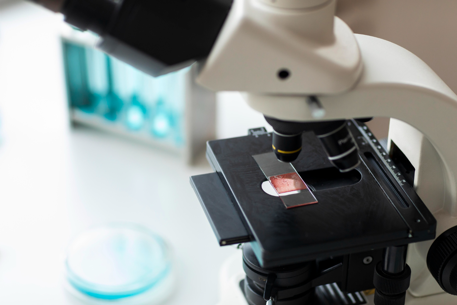 Blood Test