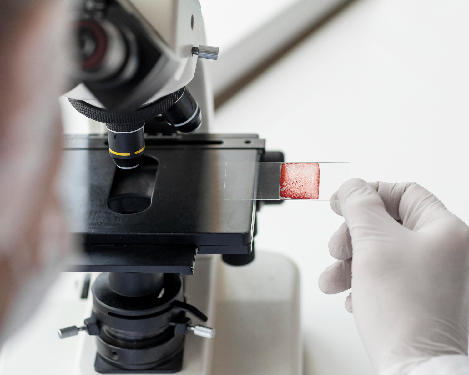 Blood Test