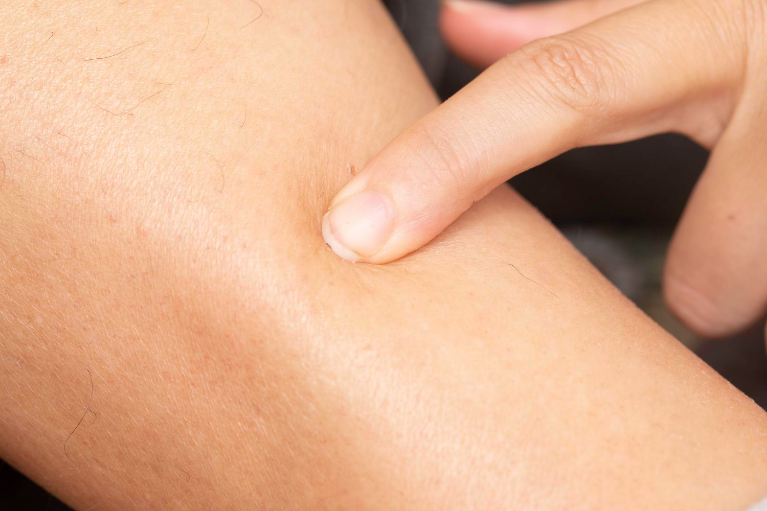 human skin