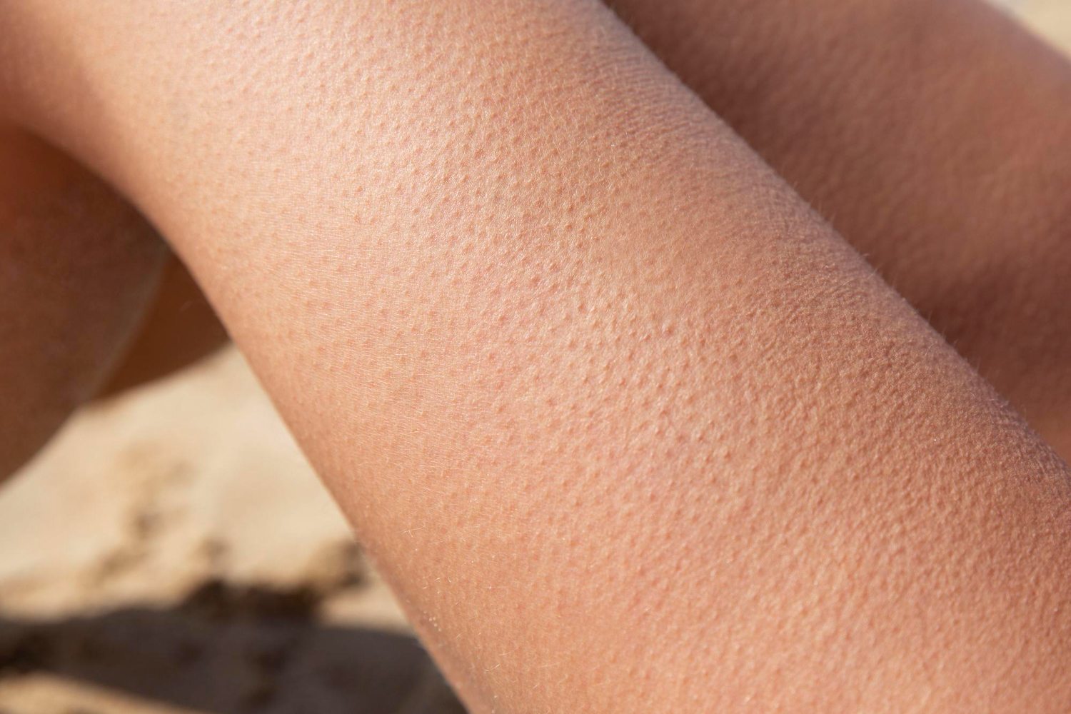 human skin
