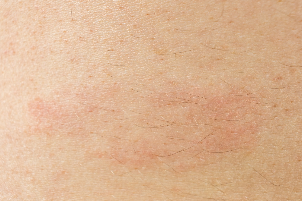 human skin