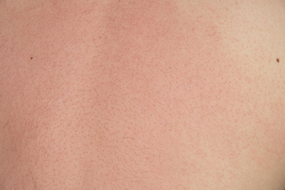 human skin