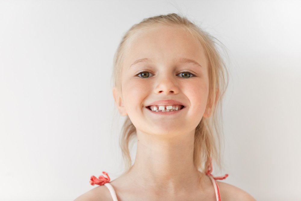 Milk Teeth