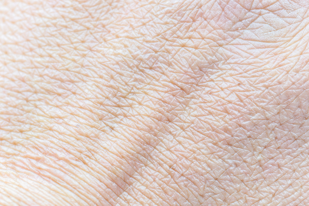 human skin