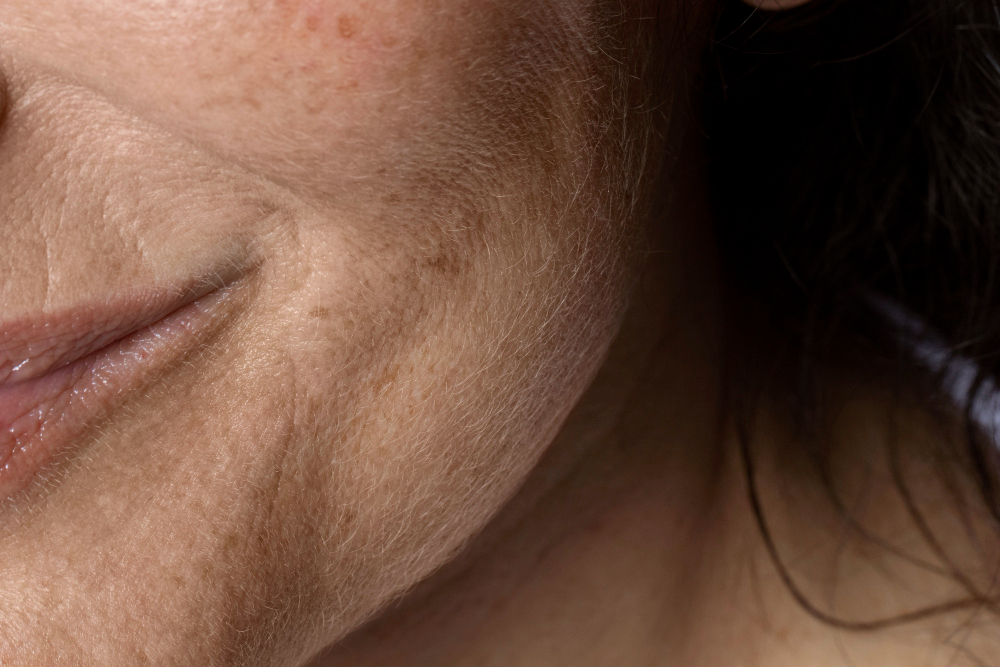 human skin