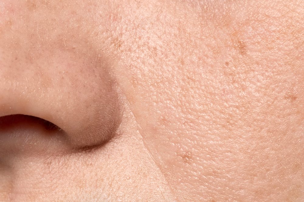 human skin