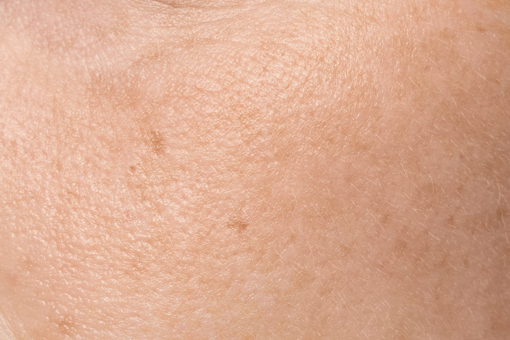 human skin