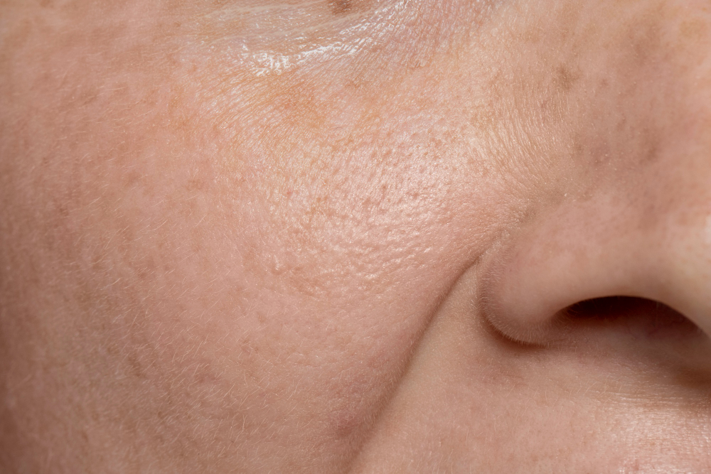 human skin