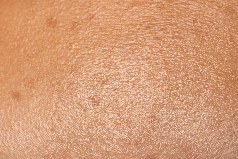 human skin