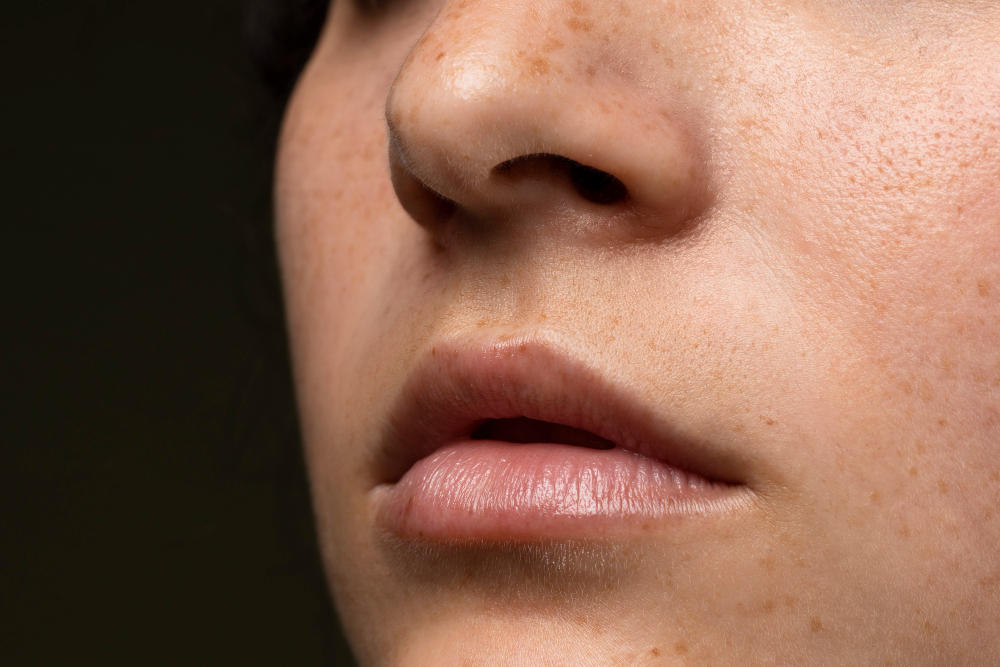 human skin