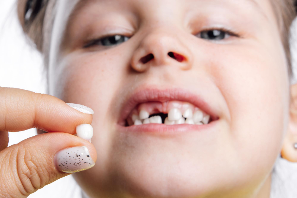 Milk Teeth