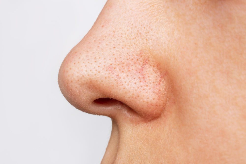 nose