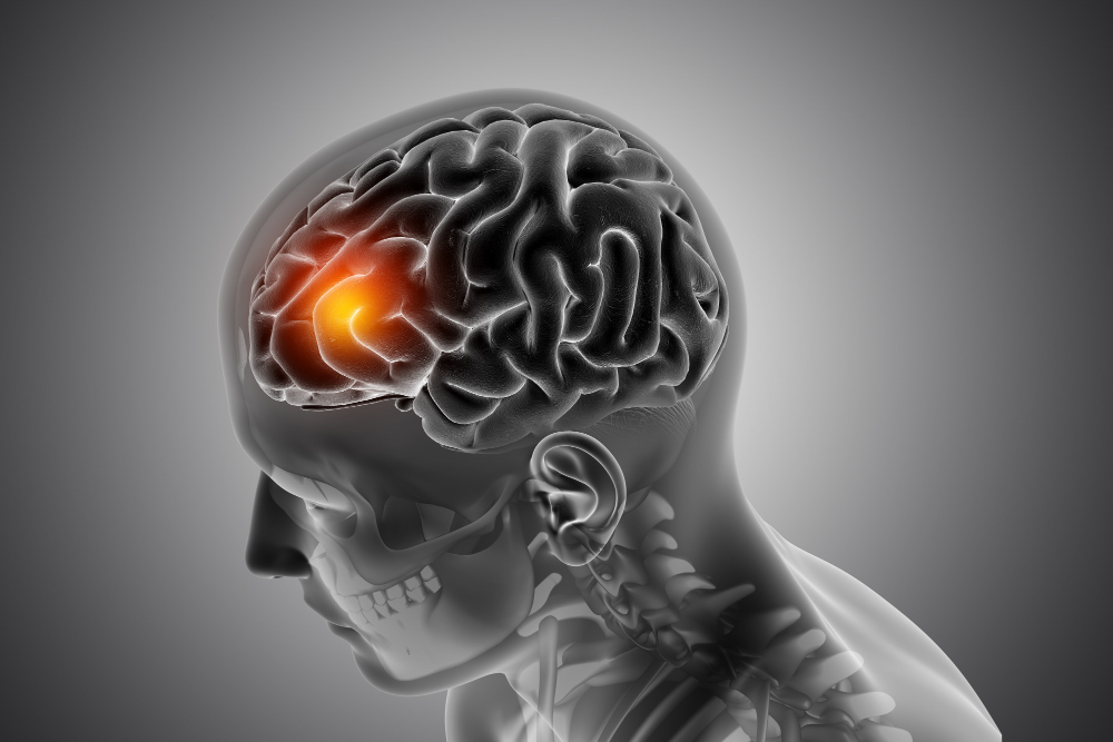 Brain