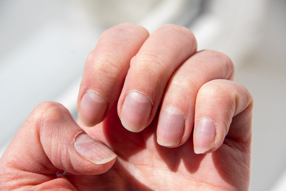 Fingernails