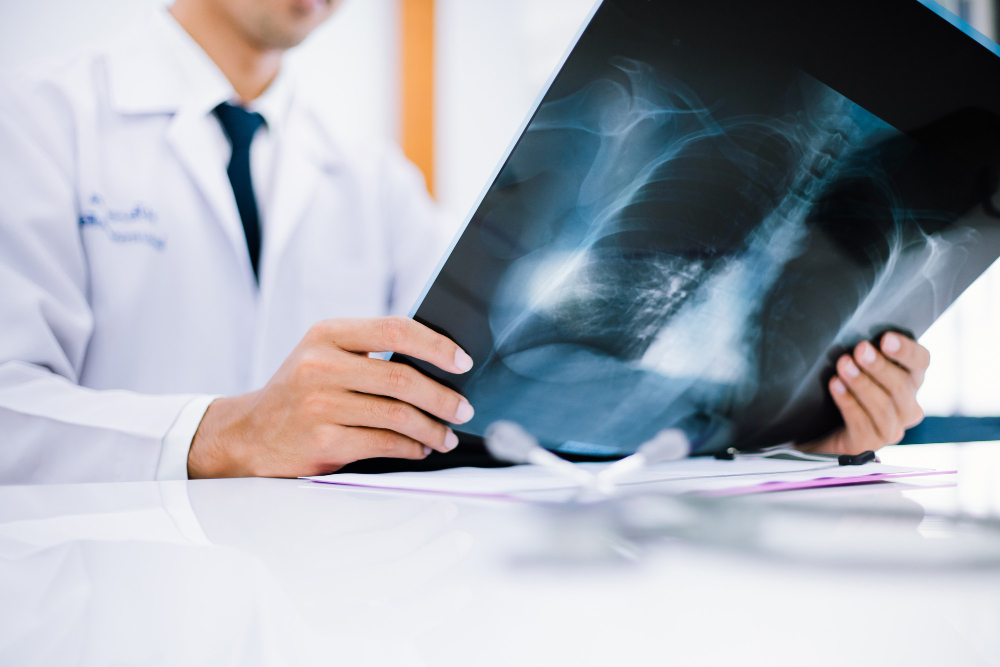 x-ray