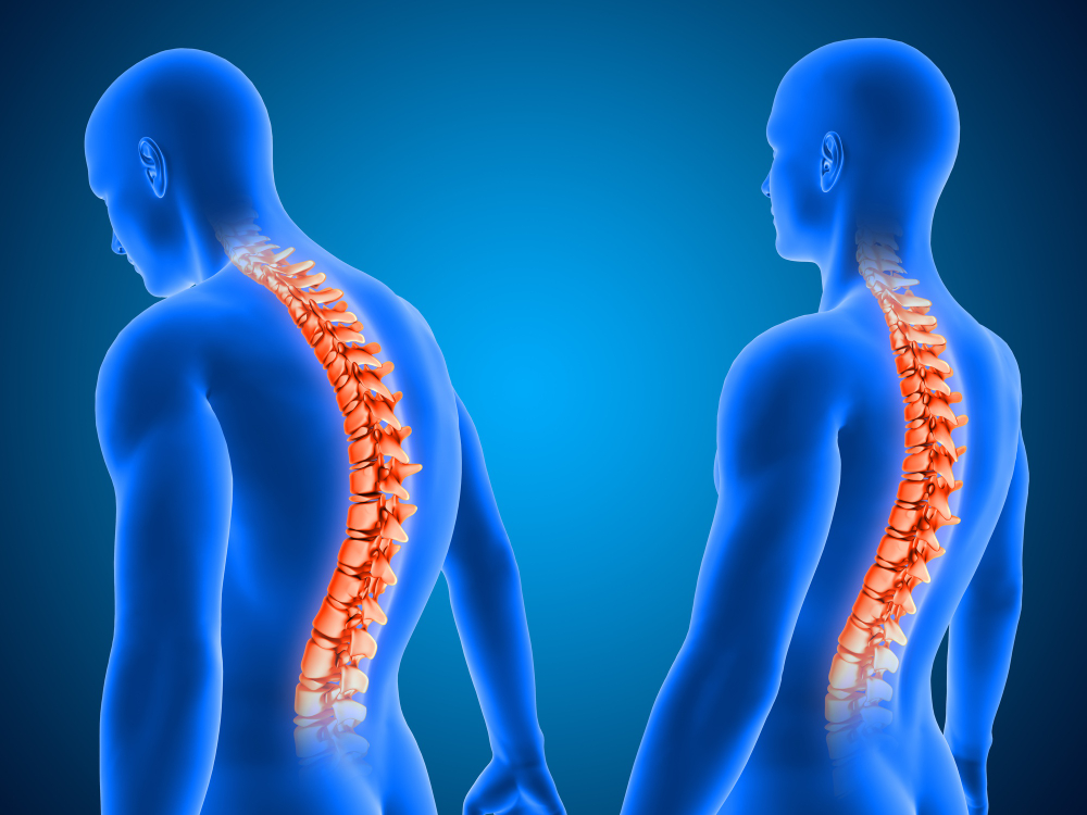 intervertebral disc