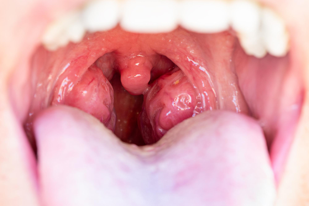 uvula