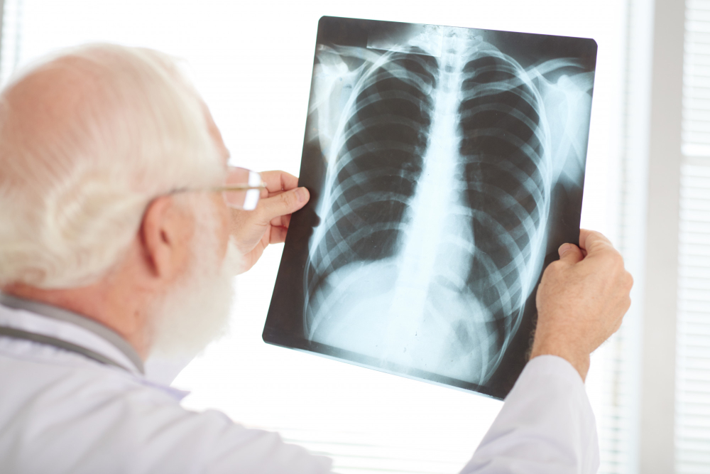 x-ray