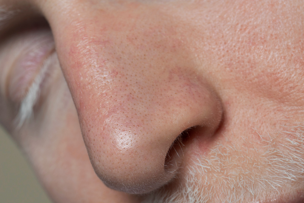 nose