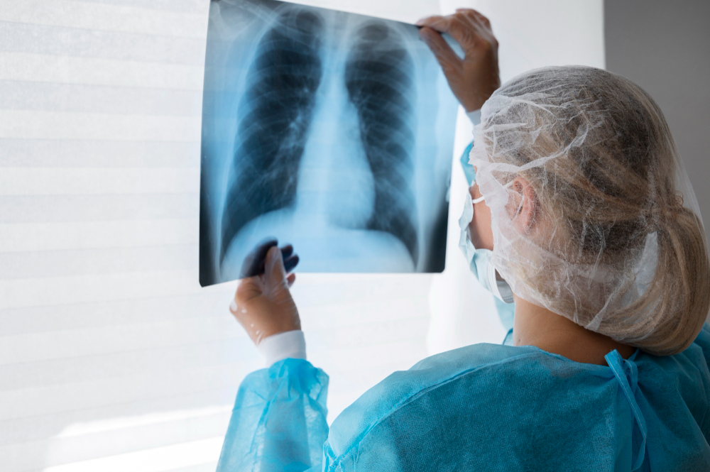 x-ray