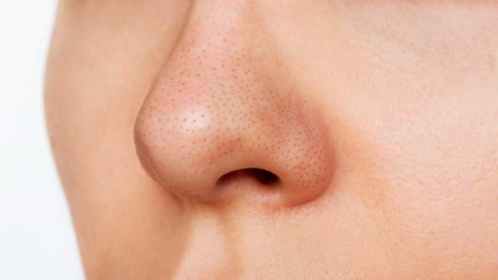 nose