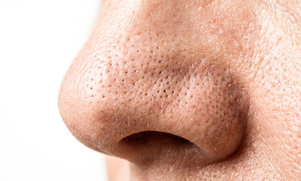 nose