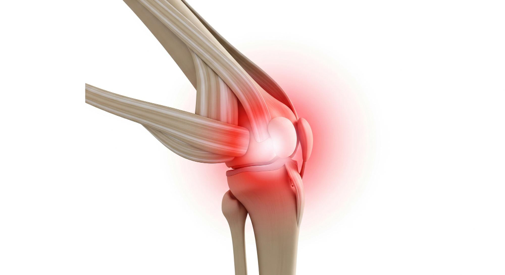 Kneecap