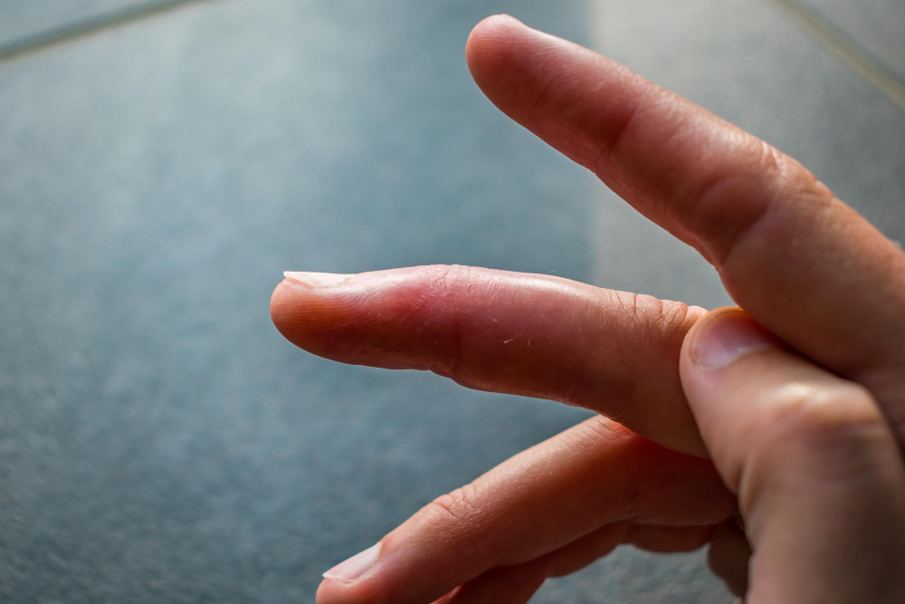 finger