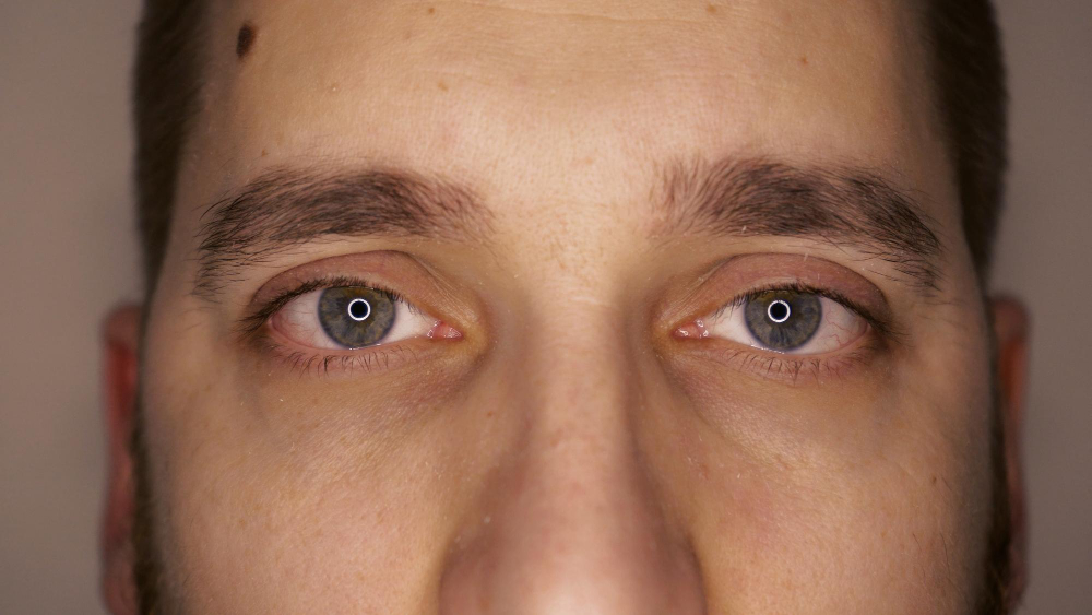 eye