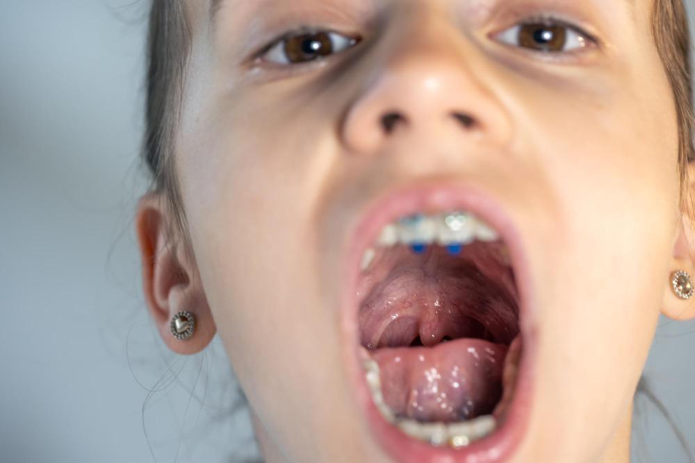 uvula