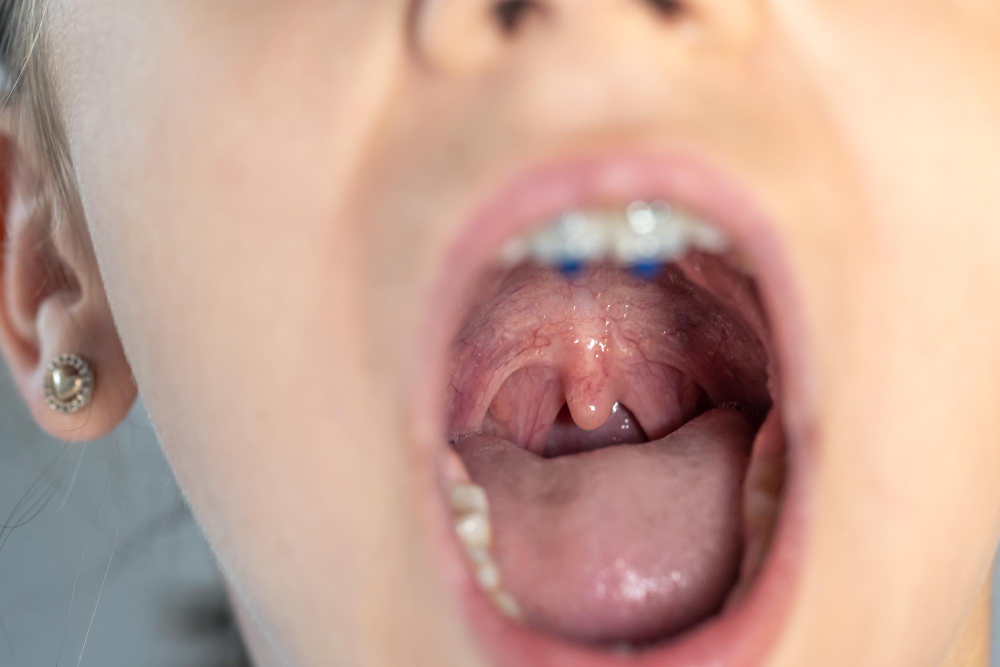 uvula