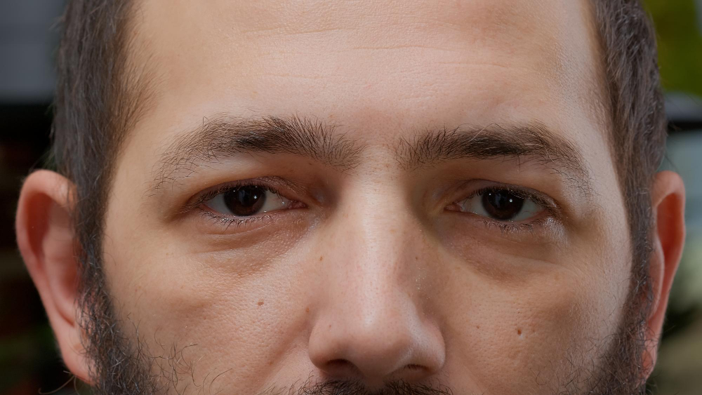 eye