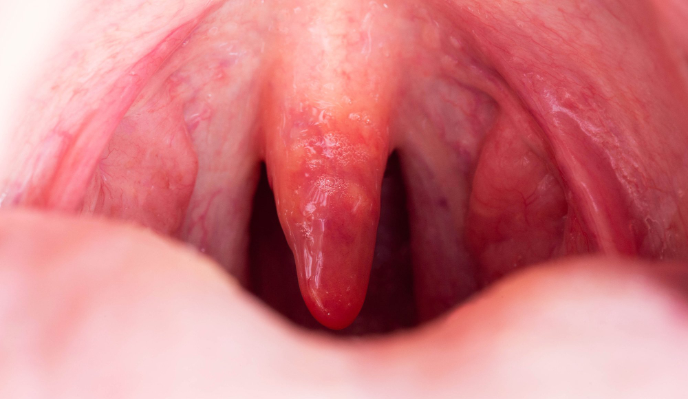 uvula