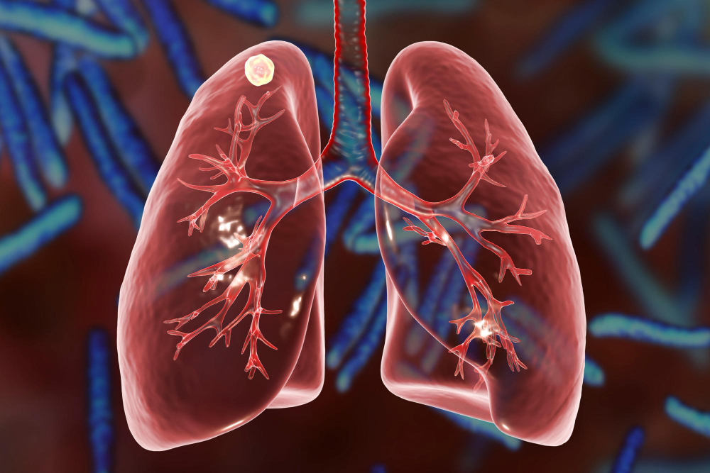 Lungs