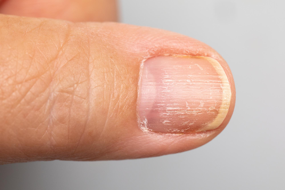 Fingernails