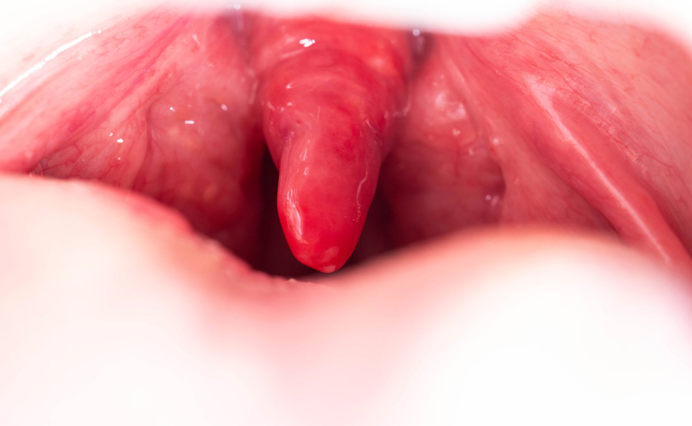 uvula