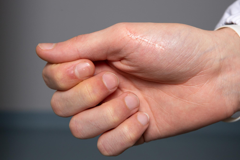finger