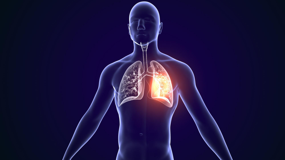 Lungs