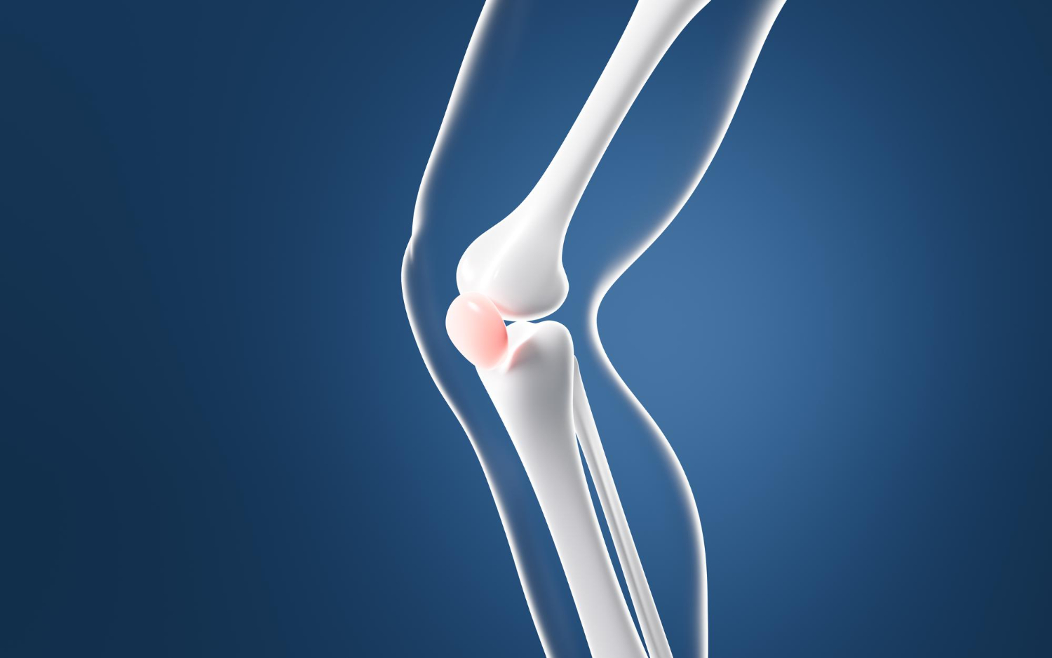 Kneecap